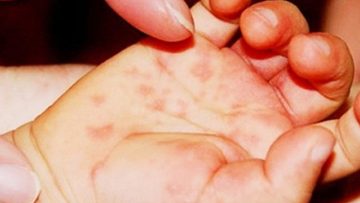 photo1594797005342-15947970057301211531241