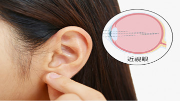 Các huyệt vị ở tai có thể giúp cải thiện bệnh cận thị… (ShutterStock/The Epoch Times)