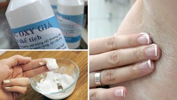 Nguồn ảnh: Internet