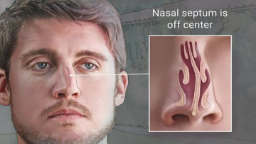 (nguồn: ssbcrack.com)