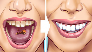 Nguồn ảnh: Internet