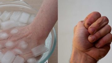 Nguồn ảnh: Internet