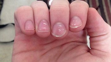 Nguồn ảnh: tuoitre.vn