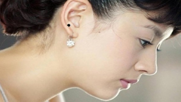 Những nốt ruồi phú quý