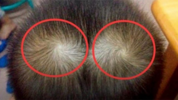 Người có 2 xoáy tóc mang số đào hoa, thông minh, giàu có