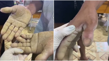 Nguồn ảnh: mucnews