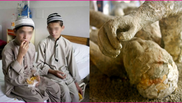 Nguồn ảnh: tinhhoa